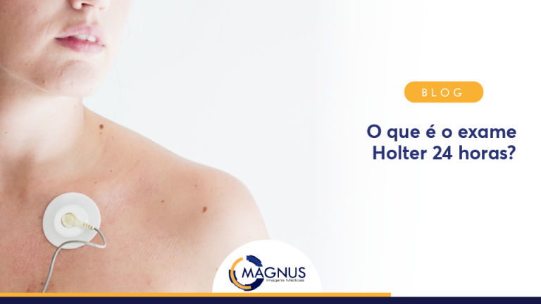 O Que é O Exame Holter 24 Horas? - Blog Magnus Imagens Médicas