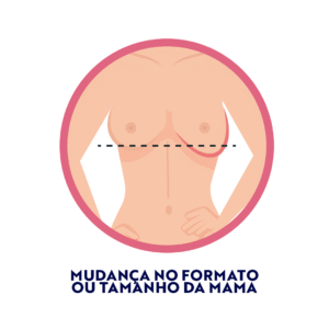 Mudança no formato ou tamanho da mama