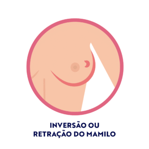 Inversão ou retração do mamilo